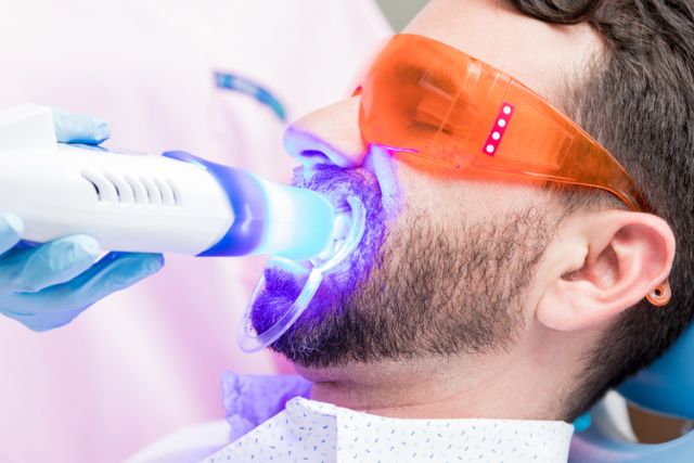 Teeth Whitening