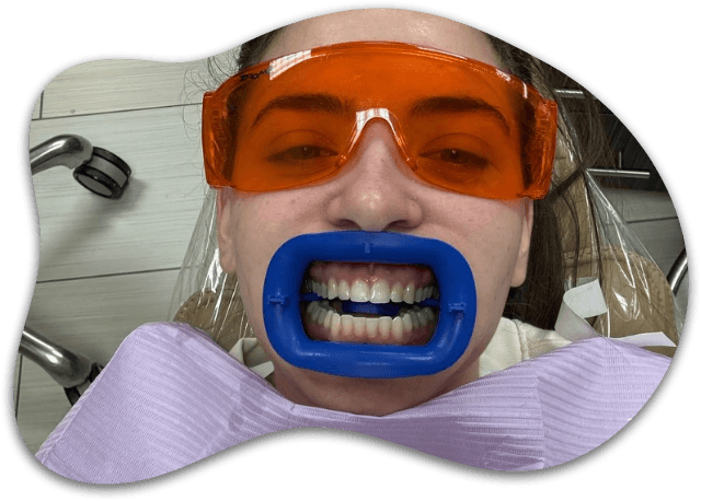 CASE 01, Super White Smiles